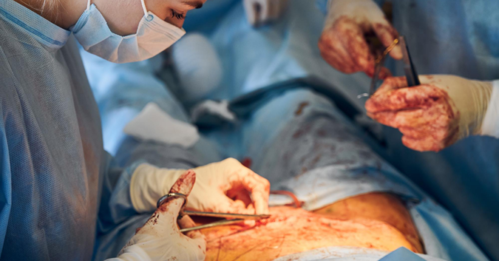 laparoscopic hysterectomy surgery in indore