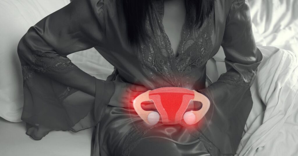 endometriosis treatment with the best gynecologist in ndore